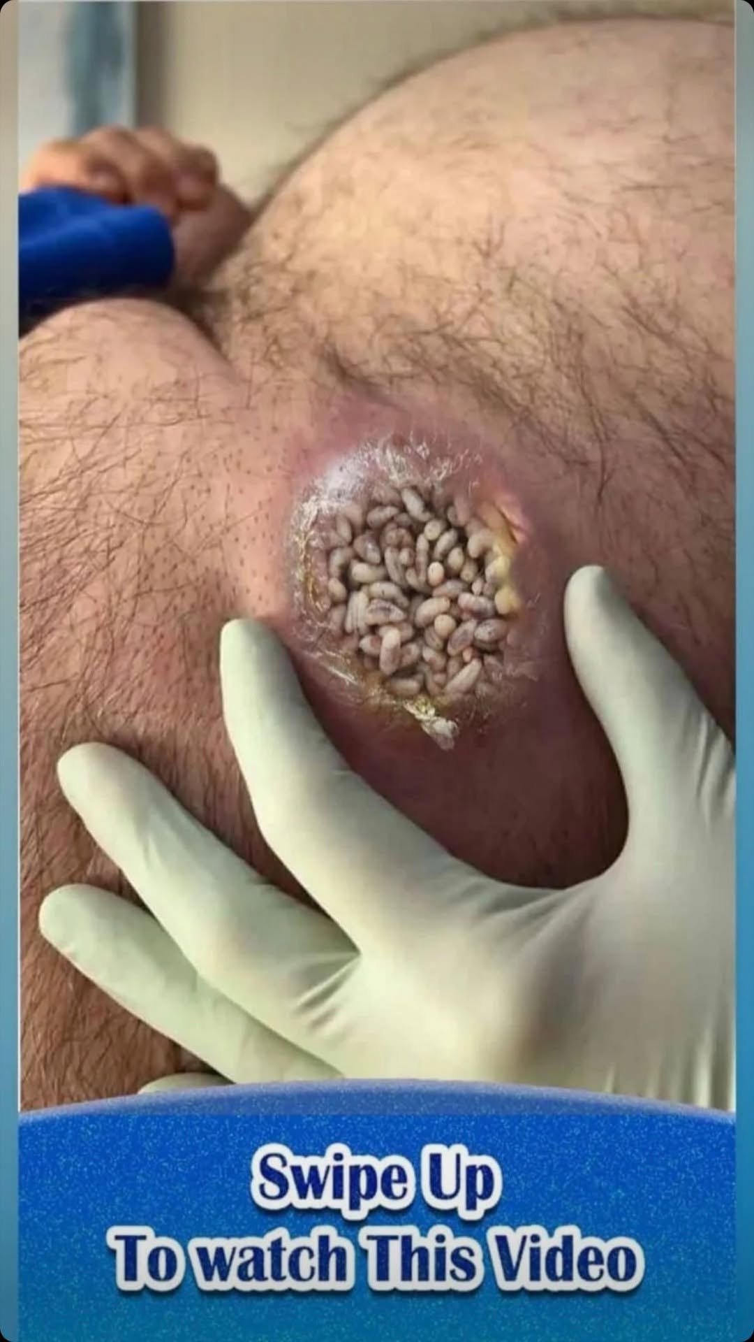 Red Dots on Your Skin? Here’s What They Could Mean!